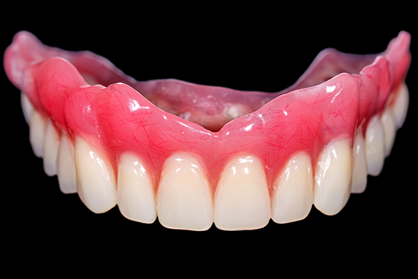 Cost of Dentures Dentures