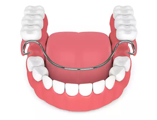 How much are partial dentures?