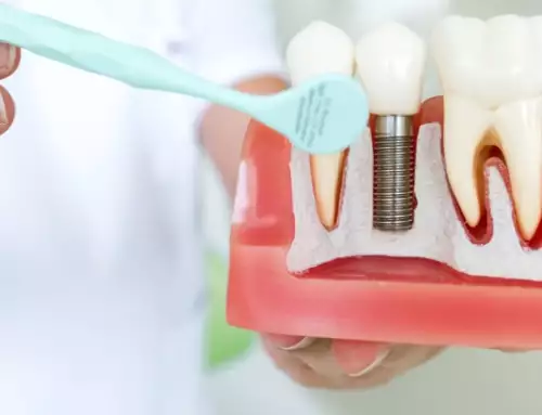 Will My Insurance Cover Dental Implants? Know Your Options